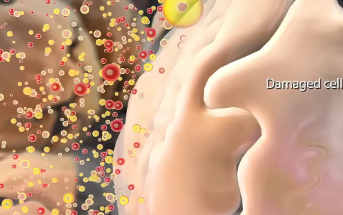 1/6癌症由炎症引起，抗炎防癌，普通人具体该怎么做？