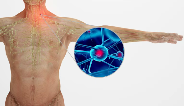 79%患者肿瘤完全消失!美国正式批准CAR-T疗法Tecartus用于复发/难治性套细胞淋巴瘤