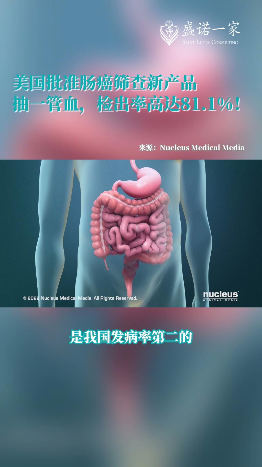 美国FDA批准新型肠癌血液检测产品SimpleScreen CRC：抽一管血检出率达81%