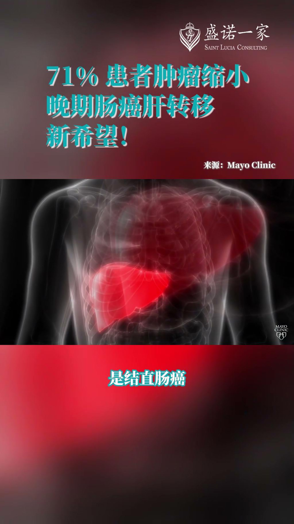 71%患者肿瘤缩小！美国新药PDS0301联合疗法使晚期肠癌肝转移迎来新希望